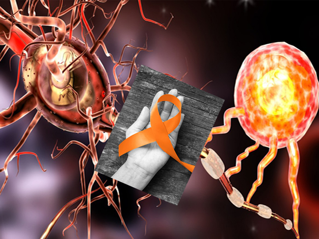 ام اس و نشانه های آن