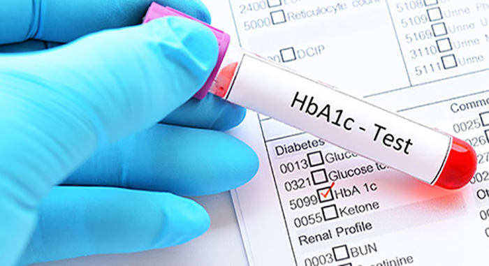 HbA1c - test